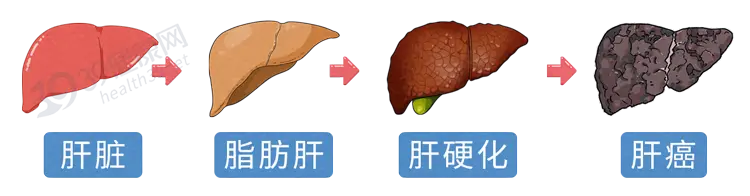 血压这样降最有效_血压一直200多降不下来_运动降血压吗